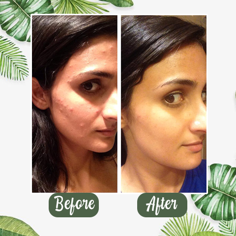Diystar™  100% Natural Green Tea Deep Cleanse Mask